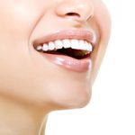 Dentist North Hollywood - Veneer Special