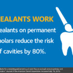 Dental Sealants - Dentist North Hollywood