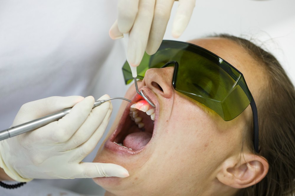 diode laser therapy - Dentist North Hollywood