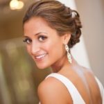 wedding Day Smile Transformation - Dentist North Hollywood