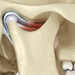 Find Relief with TMJ Treatment