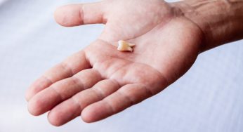 How You Benefit from Replacing a Lost Tooth