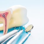 north hollywood root canal