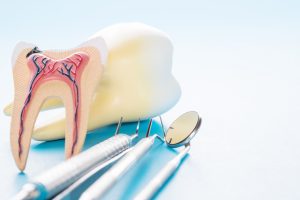 north hollywood root canal