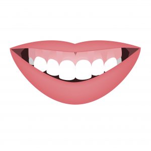 Mouth with a distal bite and high smile line or gummy smile before the orthotropics or orthotropics treatment. Vertical face growth abnormality. Vector illustration.