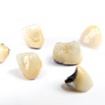 Dental ceramic tooth crowns on white background. Isolated.