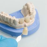 Using a shade guide to check veneer of denture parts in a dental laboratory