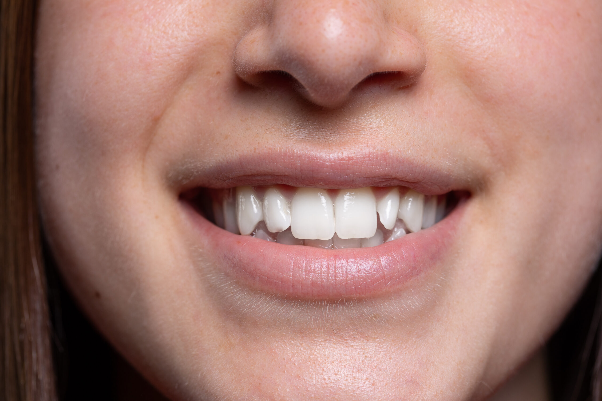 A close-up view in the mouth of a young Caucasian lady. Smiling