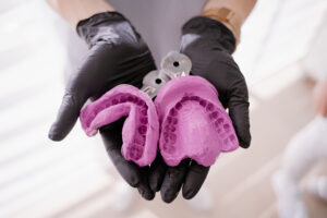 Two dental impressions in the hands of the orthodontist. Dental