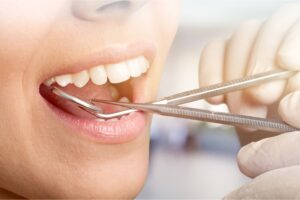 north hollywood periodontal care
