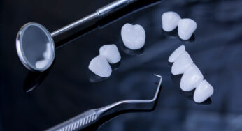 How Porcelain Veneers Improve Your Smile