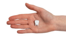 north hollywood oral surgery