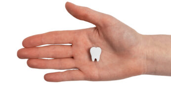 Saving Smiles With In-House Oral Surgery